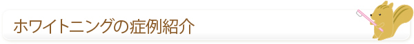 ホワイトニングの症例紹介